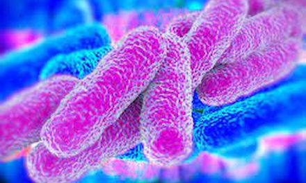 What Important Things To Know About Legionella Risk Assessment?